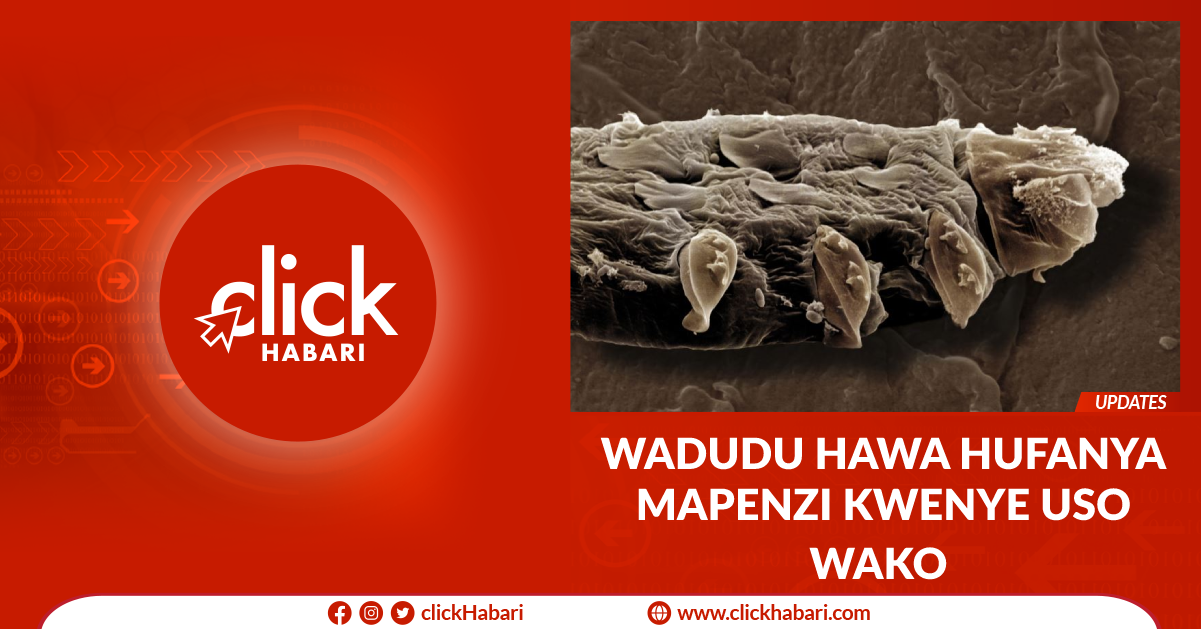 Wadudu hawa hufanya mapenzi kwenye uso wako
