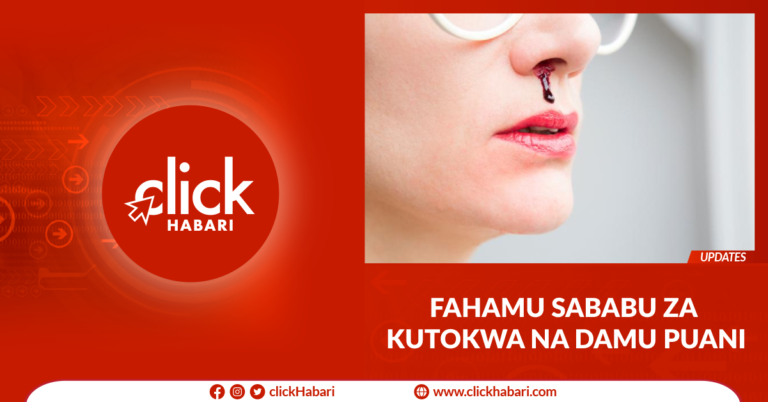 Fahamu Sababu Za Kutokwa Na Damu Puani Clickhabari Fahamu Sababu Za Kutokwa Na Damu Puani Clickhabari